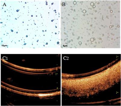 aFGF Targeted Mediated by Novel Nanoparticles-Microbubble Complex Combined With Ultrasound-Targeted Microbubble Destruction attenuates Doxorubicin-Induced Heart Failure via Anti-Apoptosis and Promoting Cardiac Angiogenesis